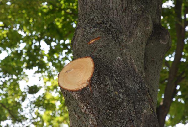 Cost of Limb Cutting in Saint Cloud